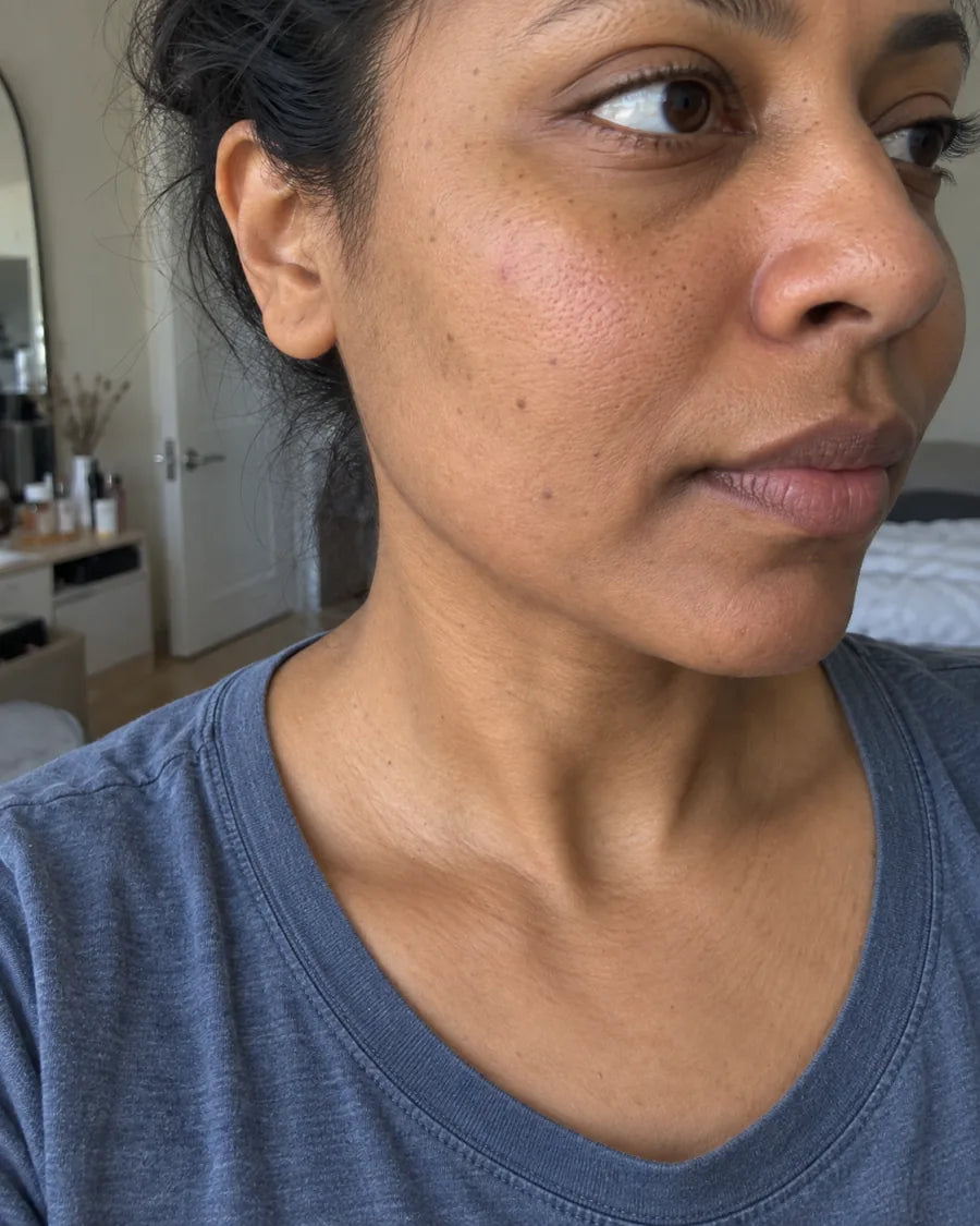 The same cheek, with the flush settled and the skin tone even