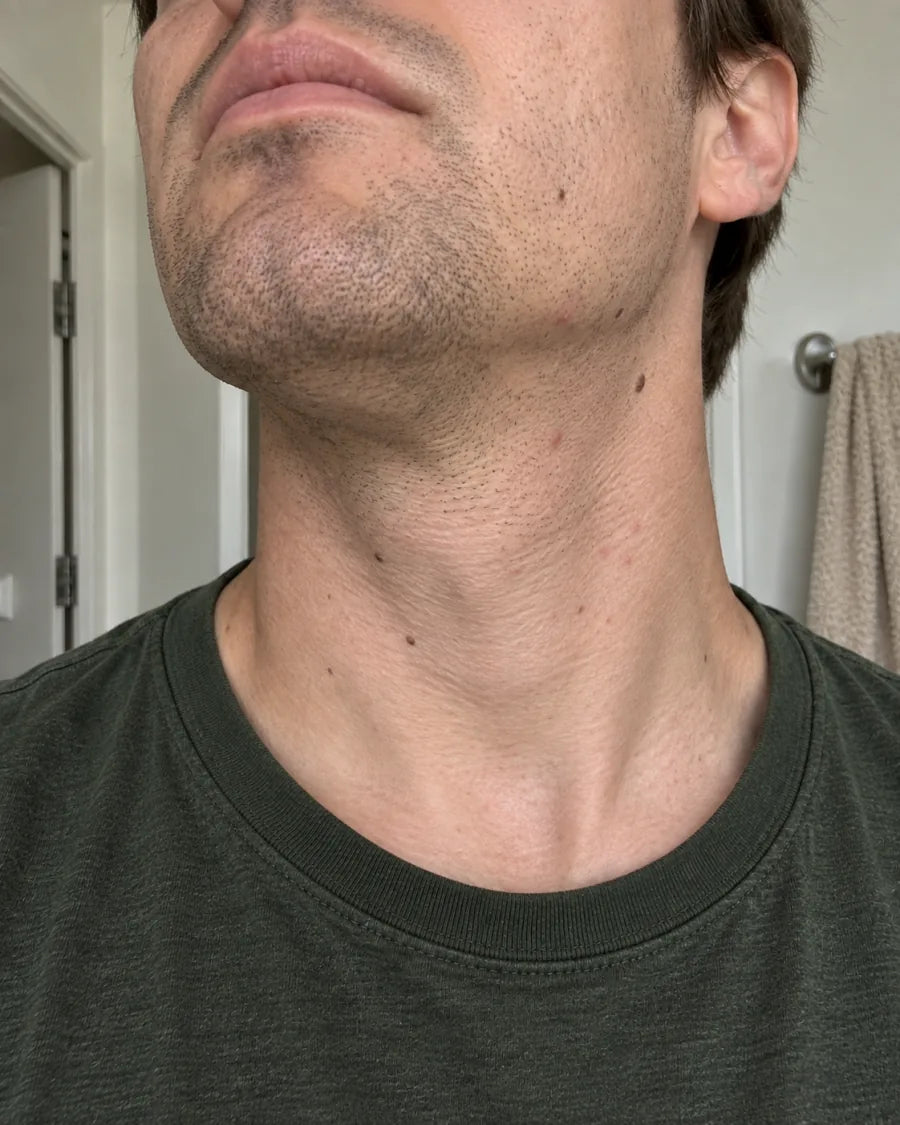 The same jaw and neck, with the bumps gone