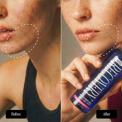 Recovery Hypochlorous Acid Face & Body Spray